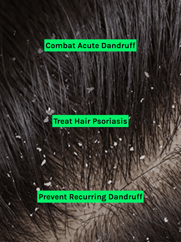 Health Benifits of Deeroz Antidandruff Oil